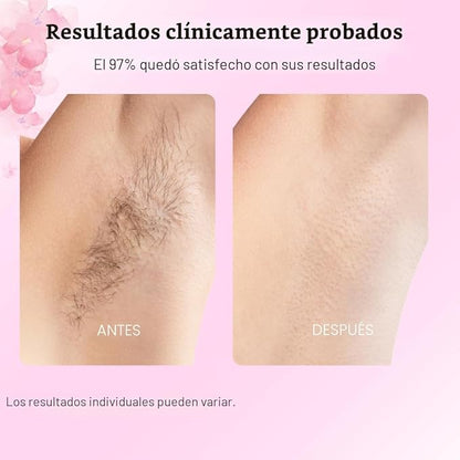 🌿 Aceite Depilatorio Botánico | Piel Suave y Lisa por Más Tiempo
