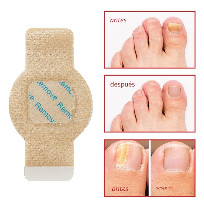 🍄 Parches Reparadores para Hongos en las Uñas (21 Parches)