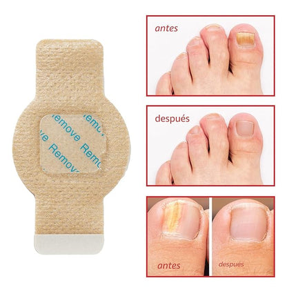 🍄 Parches Reparadores para Hongos en las Uñas (21 Parches)