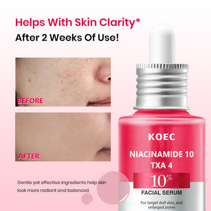 Serum Facial ANUA Niacinamida 10% + Ácido Tranexámico 4% 💧 | Piel Radiante y Sin Manchas